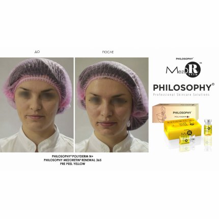 Biphasic Pre Peel Yellow Med Peel With Idebenone Renewal 365 / Желтый пилинг с идебиноном и маслом персиковой косточки, 7 мл*2(изображение 3)