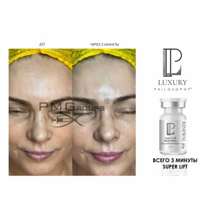 Stem Cell Med Peel Renewal 369 /Пилинг с аминокислотами и ГК, стволовыми клетками яблока, 7 мл * 2(изображение 2)