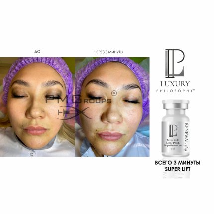 Stem Cell Med Peel Renewal 369 /Пилинг с аминокислотами и ГК, стволовыми клетками яблока, 7 мл * 2(изображение 3)